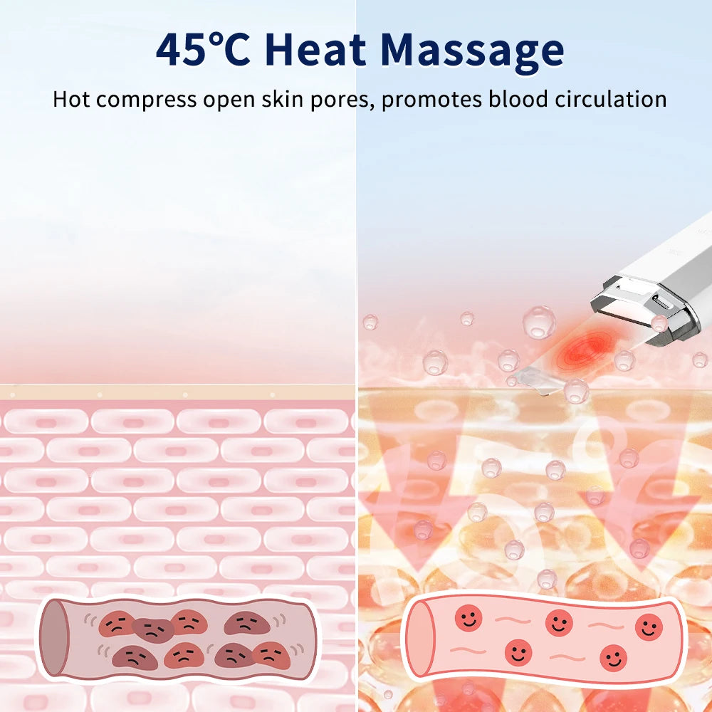 ANLAN ultrasonic skin scrubber with EMS micro-current and ion infusion modes
