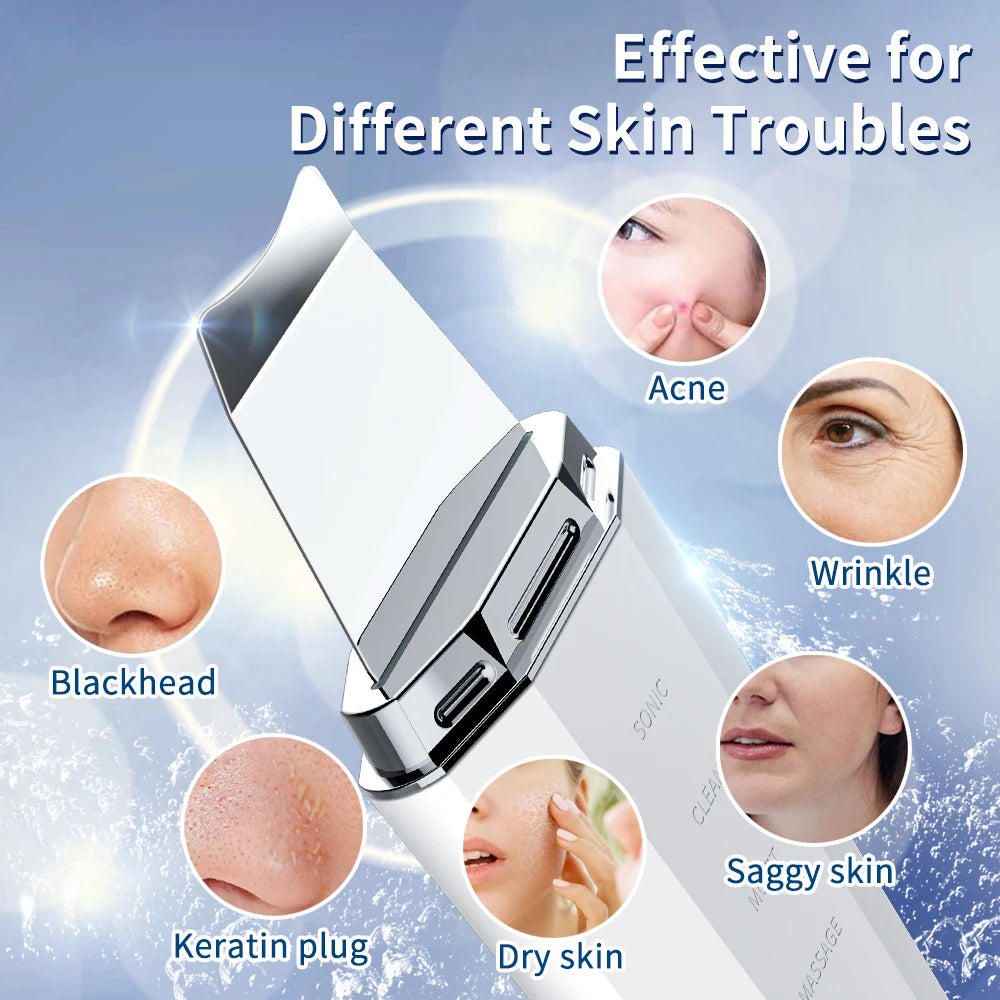 Anlan 5-in-1 ultrasonic skin scrubber device