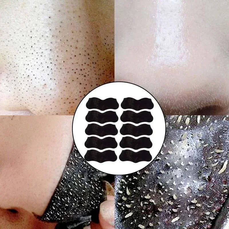 Blackhead Remover Mask