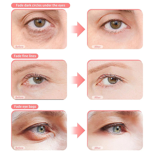 Eye Rejuvenation Massager Glasses